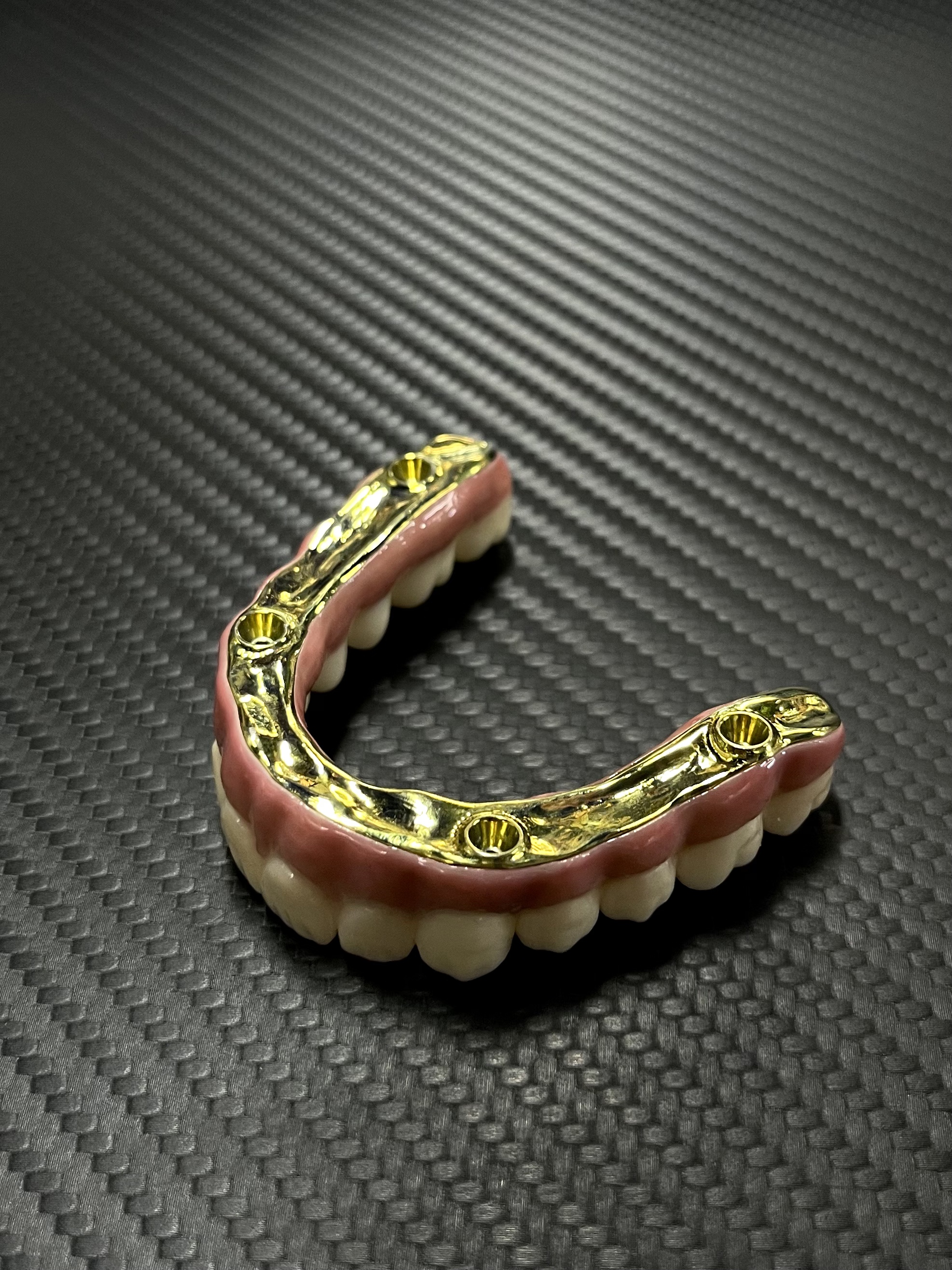 Implant - IBar